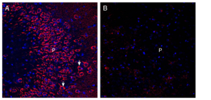 Anti-Neuronal Pentraxin Receptor (NPTXR)(extracellular) Antibody