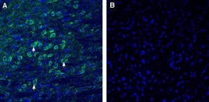 Anti-CADM1/SynCAM (extracellular) Antibody