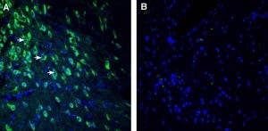 Anti-SEZ6 (extracellular) Antibody