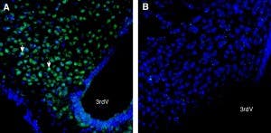 Anti-PTGFRN (extracellular) Antibody