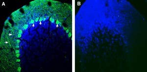 Anti-SLIT1 Antibody
