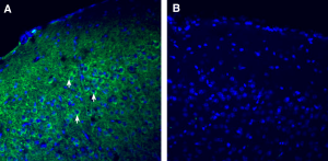 Anti-SPARC Antibody