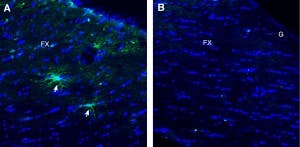 Anti-TMEM108 (extracellular) Antibody