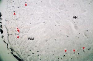Anti-Neurotrophin 4 (NT-4) Antibody
