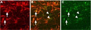 Anti-proNGF Antibody