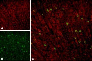 Anti-Sortilin (extracellular) Antibody