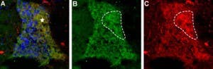 Anti-proNT-3 Antibody