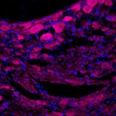 Anti-TrkA (extracellular)-ATTO Fluor-633 Antibody