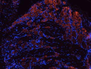 Anti-TrkB (extracellular) Antibody