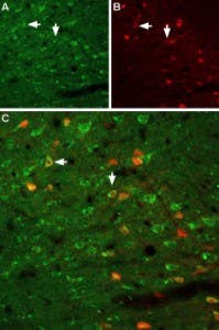 Anti-GFR alpha 1 (extracellular) Antibody