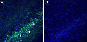 Anti-SLC25A22 (GC1) Antibody