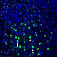 Anti-MANF/ARMET Antibody