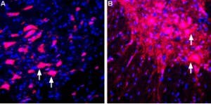 Anti-LINGO-1 (extracellular) Antibody