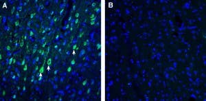 Anti-CART Antibody