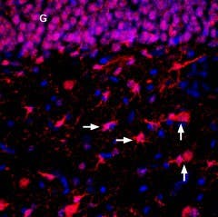 Anti-ENT2 (SLC29A2) Antibody