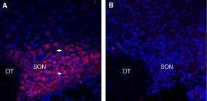 Anti-PMAT (SLC29A4) Antibody