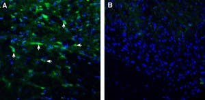 Anti-ENPP1 (extracellular) Antibody