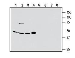 Anti-Human ASCT2/SLC1A5 (extracellular) Antibody