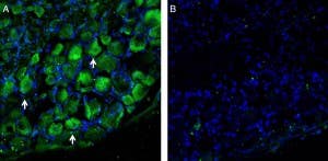 Anti-LAT1 (SLC7A5) Antibody