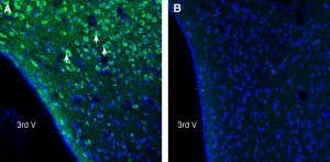 Anti-UCP2 Antibody