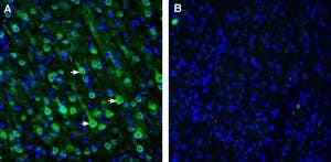 Anti-SLC47A1 Antibody
