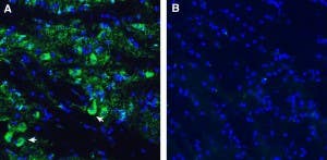 Anti-SLC10A4 (extracellular) Antibody