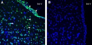 Anti-SLC38A2 (SNAT2) Antibody