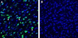 Anti-SLC38A9 Antibody