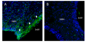 Anti-CAT-1 (SLC7A1) (extracellular) Antibody