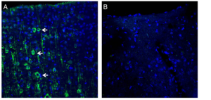 Anti-MAGT1 (extracellular) Antibody