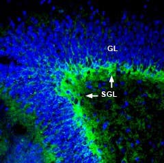 Anti-ASCT1 (SLC1A4) Antibody