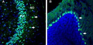 Anti-Kidins220 Antibody