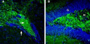 Anti-Synapsin II (SYN2) Antibody