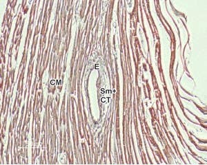 Anti-NCX1 (SLC8A1) Antibody