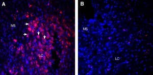 Guinea Pig Anti-Orexin Receptor 1 Antibody