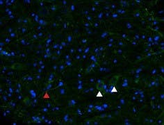 Anti-µ-Opioid Receptor (OPRM1) (extracellular) Antibody