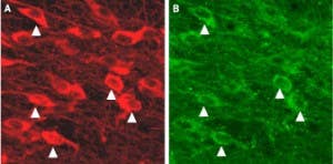Anti-KCNN3 (K<sub>Ca</sub>2.3, SK3) (N-term) Antibody