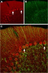 Anti-HCN2 Antibody
