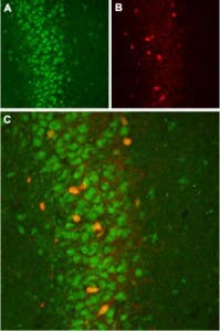 Anti-<em>slo</em>β2 (KCNMB2) Antibody