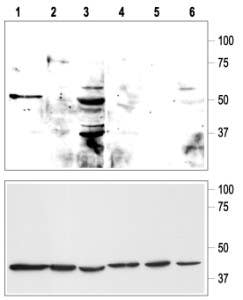 Anti-KCNK9 (TASK-3) (extracellular) Antibody