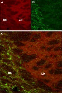 Anti-HCN4 Antibody