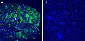 Anti-TMEM150C/Tentonin 3 (extracellular) Antibody