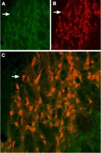 Anti-KCNH6 (erg2) Antibody