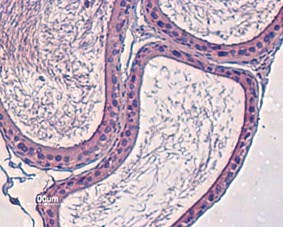 Anti-K<sub>V</sub>12.3 (KCNH4) Antibody