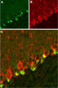 Anti-K<sub>V</sub>β2 Antibody
