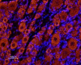 Anti-KCNK18 (TRESK) (extracellular) Antibody