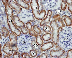 Anti-K<sub>ir</sub>5.1 Antibody