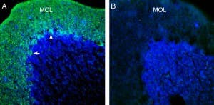 Anti-KCNT1 (Slack) Antibody
