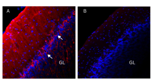 Anti-K<sub>V</sub>1.1 (KCNA1) (extracellular) Antibody