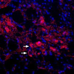 Anti-KCNQ4 Antibody